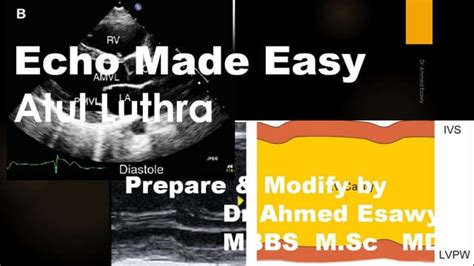 Echocardiography – What you need to know .